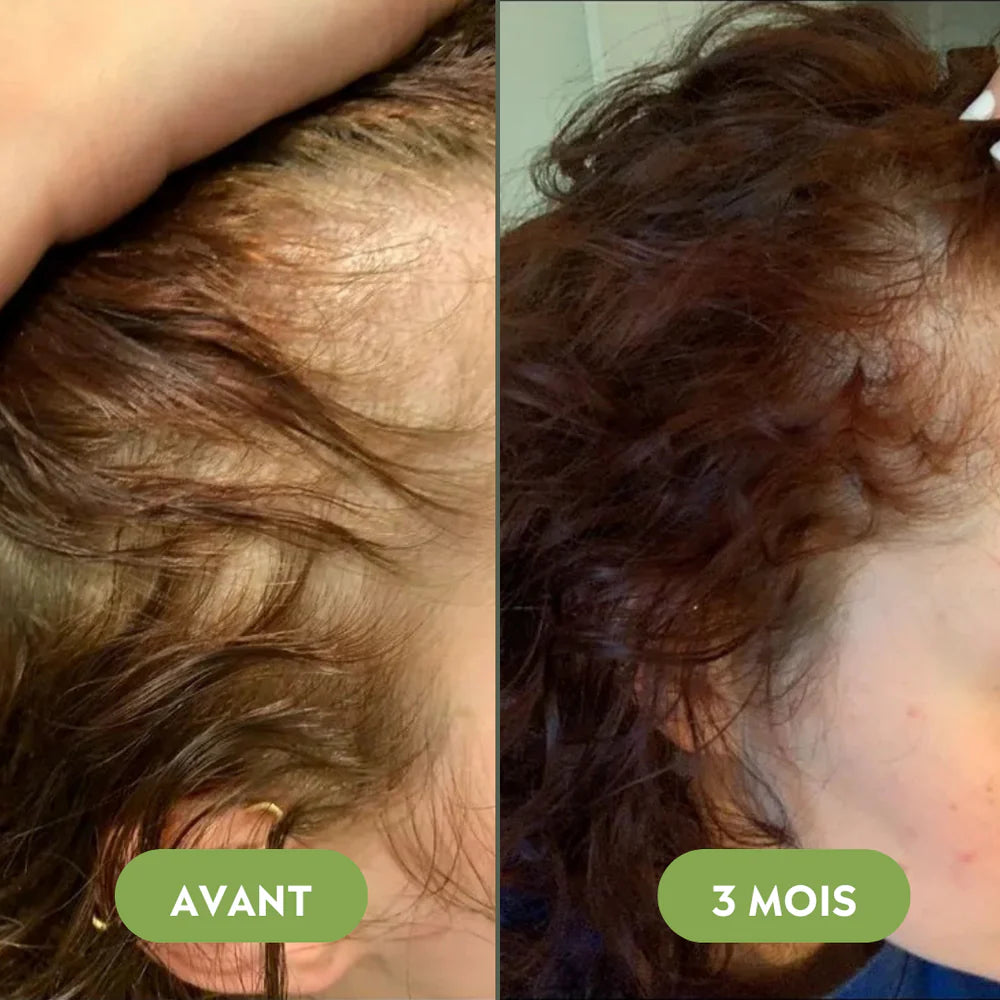 Sérum de croissance pour cheveux (60ml)