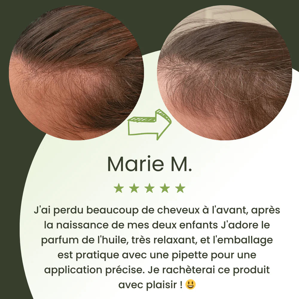 Sérum de croissance pour cheveux (60ml)