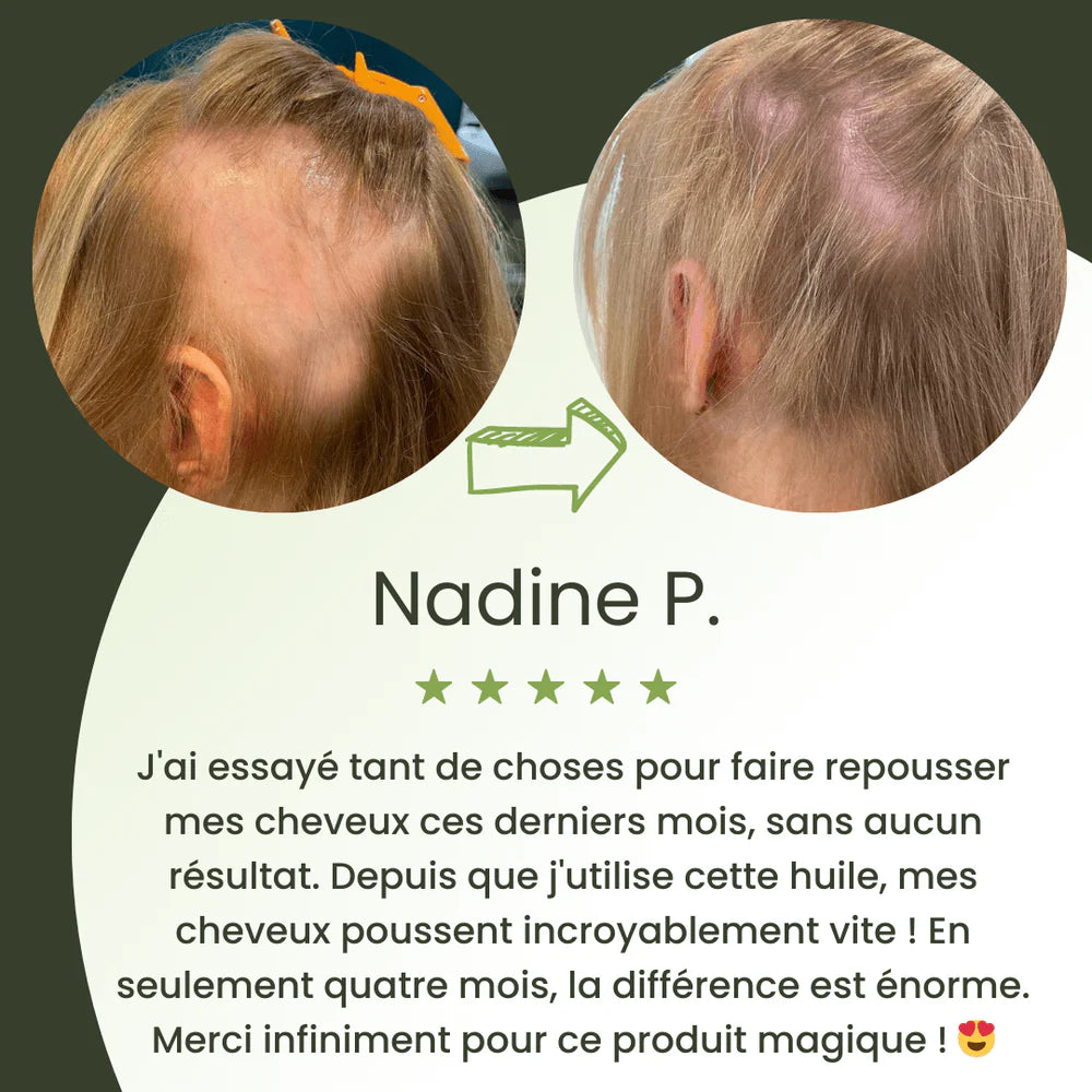 Sérum de croissance pour cheveux (60ml)